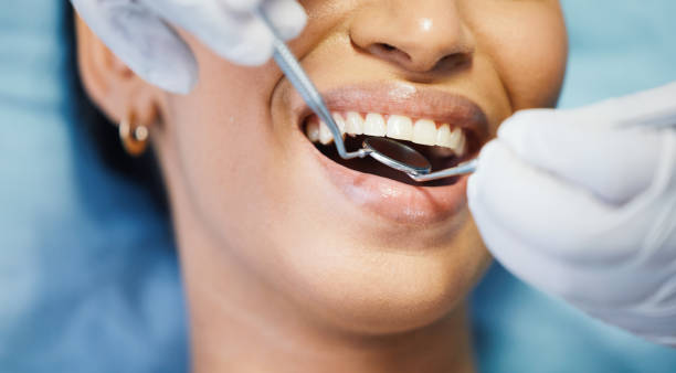 Best Emergency Dental Care for Abscessed Tooth in Lucedale, MS