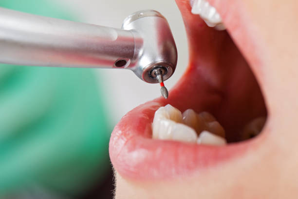 Best Pediatric Emergency Dentist in Lucedale, MS
